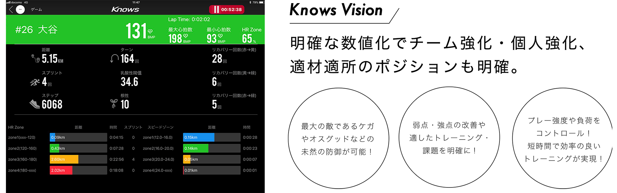 knowsvision